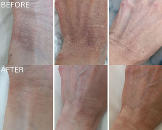 Repairing Skin Barrier with BOTANICSENS