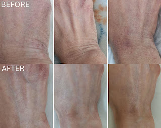 Repairing Skin Barrier with BOTANICSENS